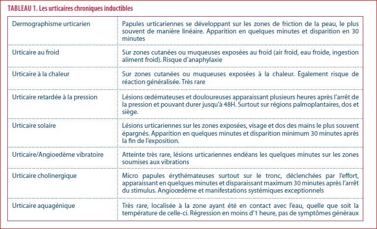 Urticaire au froid | Louvain Médical