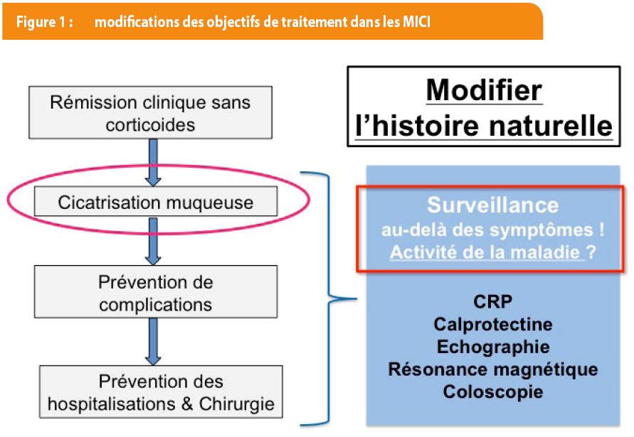 Maladie de Crohn et rectocolite : quelle stratégie thérapeutique ...