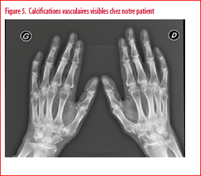 Piège de la médecine diagnostique : une cause rare d'ulcères des ...