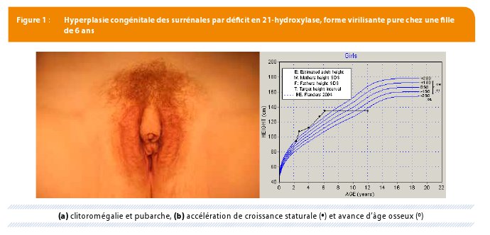 Pubarche prématurée : quand faut-il s'inquiéter ? | Louvain Médical